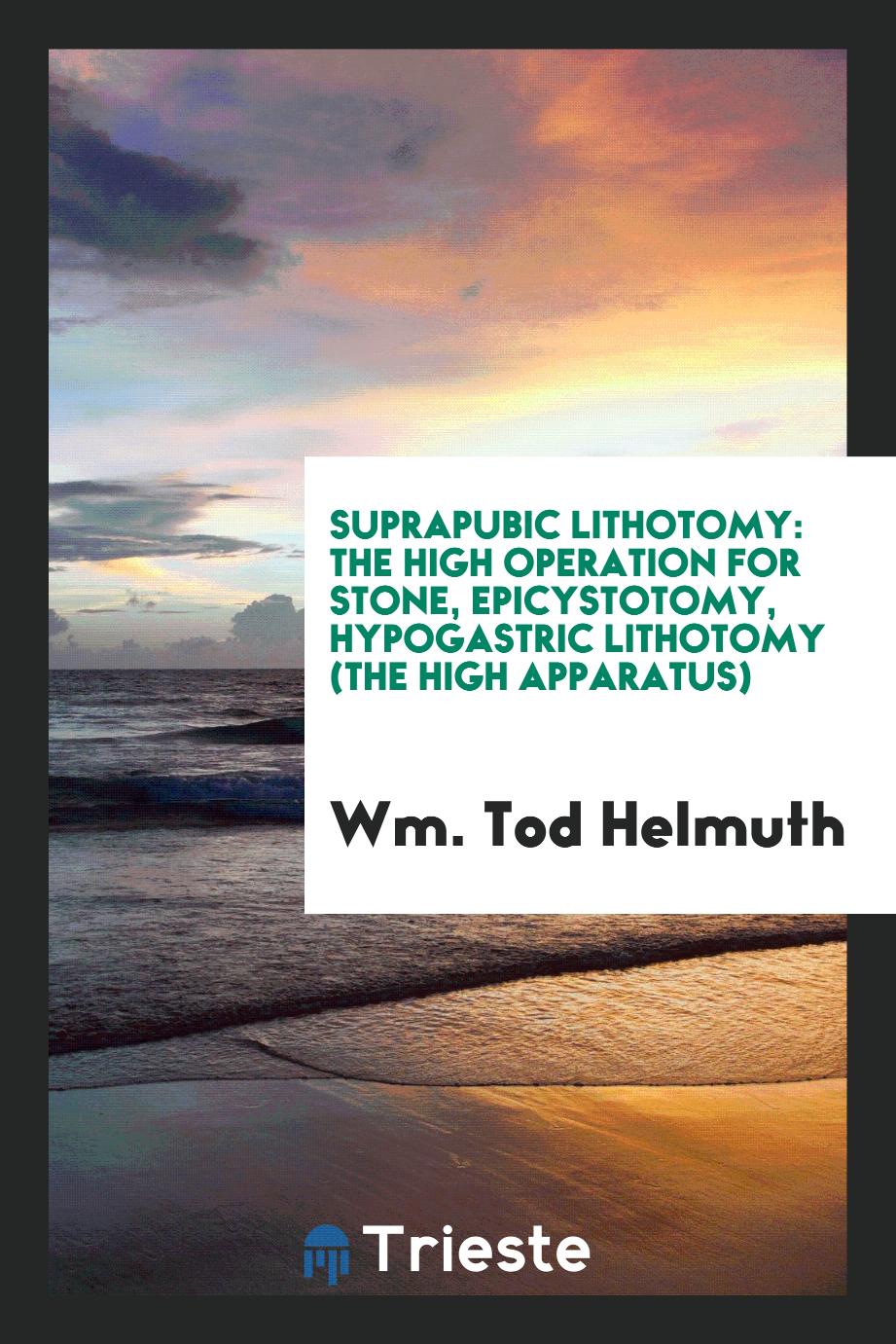 Suprapubic Lithotomy: The High Operation for Stone, Epicystotomy, Hypogastric Lithotomy (the High Apparatus)
